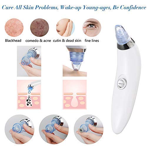 4 In 1 Advanced Pore Vacuum System