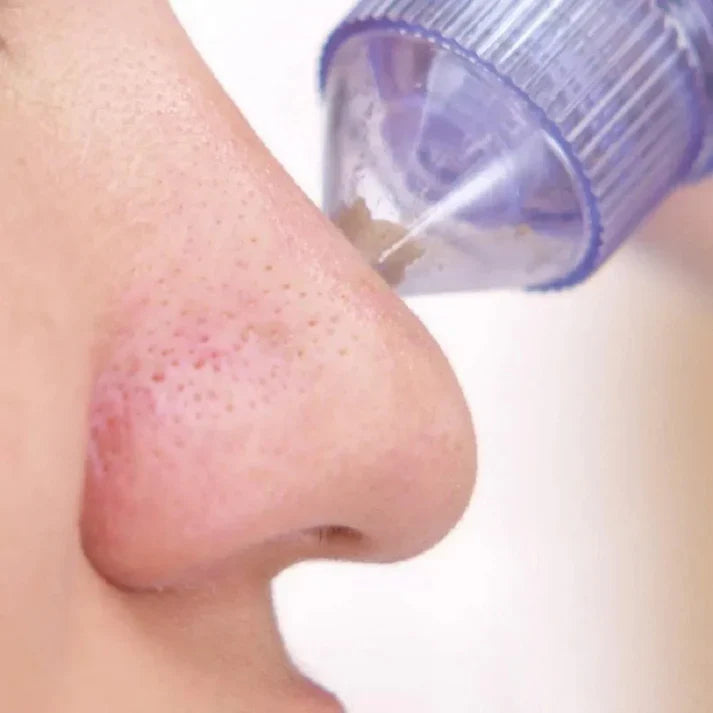 4 In 1 Advanced Pore Vacuum System